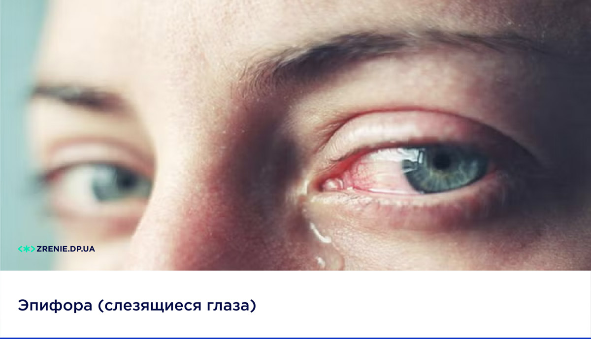 Что такое эпифора