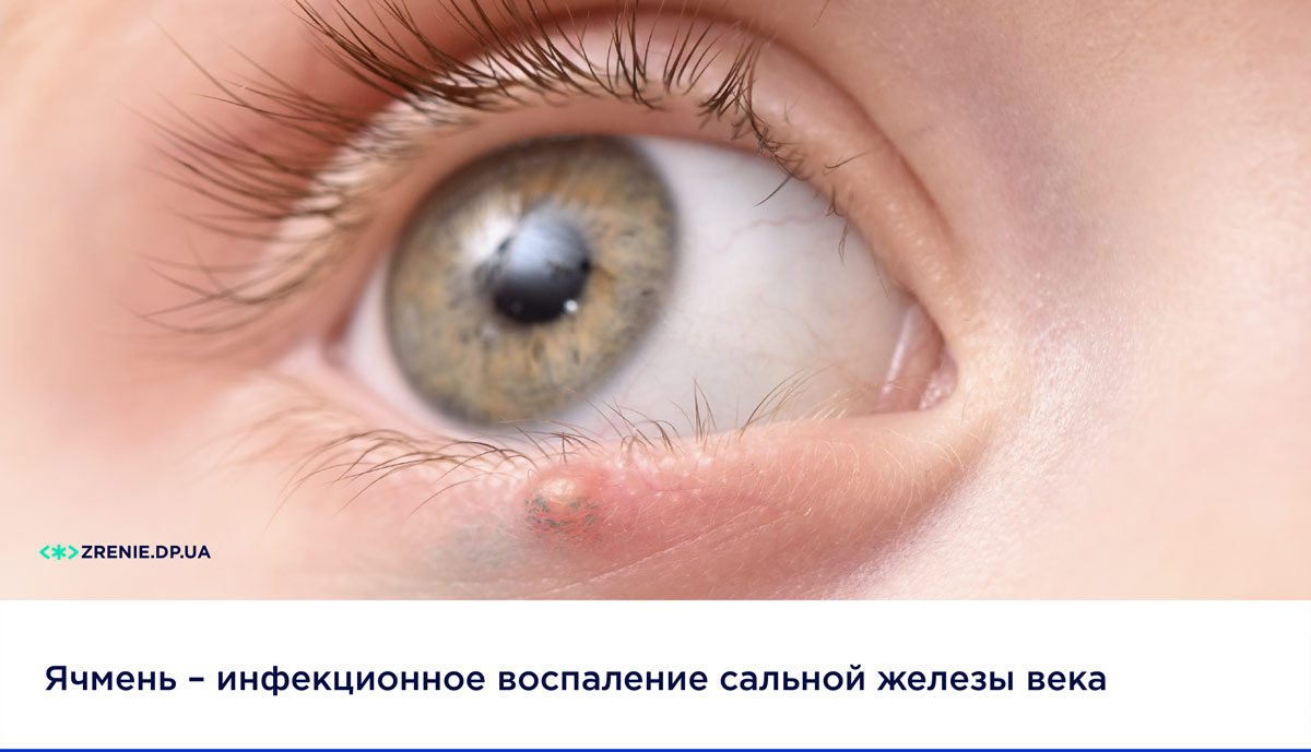 Воспалительные заболевания глаз